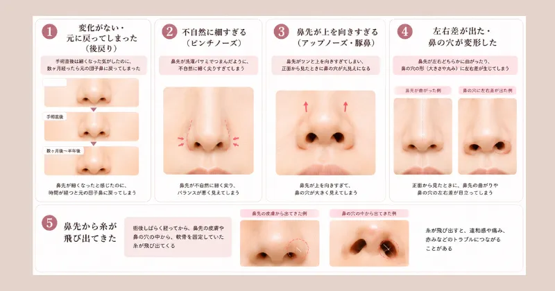 鼻尖形成でよくある失敗例(後悔事例)と原因