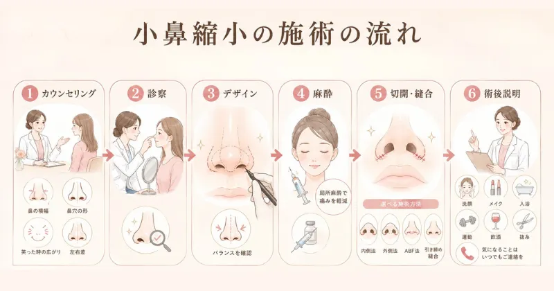 小鼻縮小の施術の流れ