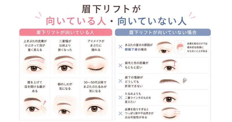 眉下リフトが向いている人・向いていない人