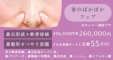 春のぽかぽかフェア※モニター価格です。軟骨移植＋鼻尖形成496,000円→260,000円 鼻整形オペやり放題定額55万円　耳介軟骨移植、鼻尖形成オープン法、鼻プロテーゼ、鼻翼縮小切開法、鼻柱形成、鼻メッシュ、鼻ヒアルロン酸