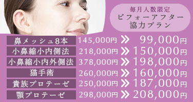 毎月人数限定 ビフォーアフター協力プラン。鼻メッシュ8本145,000円→99,000円小鼻縮小内側法218,000円→150,000円小鼻縮小内外側法378,000円→198,000円猫手術260,000円→160,000円貴族プロテーゼ250,000円→187,000円顎プロテーゼ298,000円→208,000円