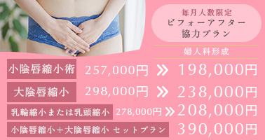 毎月人数限定 ビフォーアフター協力プラン。小陰唇縮小術 257,000円→198,000円 大陰唇縮小 298,000円→238,000円 乳頭縮小または乳輪縮小　278,000円→208,000円 小陰唇縮小＋大陰唇縮小セットプラン 390,000円