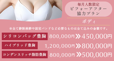 毎月人数限定 ビフォーアフター協力プラン。シリコンバッグ豊胸　800,000円→450,000円 ハイブリッド豊胸　200,000円→800,000円 コンデンスリッチ脂肪豊胸　800,000円→500,000円 ※全て静脈麻酔や固定バンドなど必要なものは全て込みの金額です。