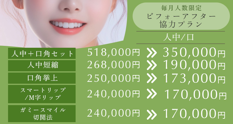 毎月人数限定 ビフォーアフター協力プラン。人中+口角セット518,000円→350,000円 人中短縮 268,000円→190,000円 口角挙上 250,000円→173,000円 スマートリップ/M字リップ 240,000円→170,000円 ガミースマイル切開法 240,000円→170,000円