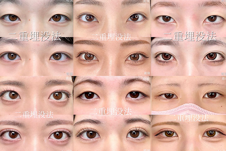 まるやま美容の症例
